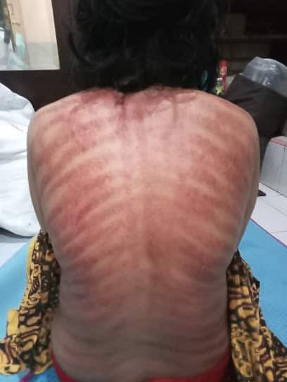 Tukang Urut Terdekat Taman Sari